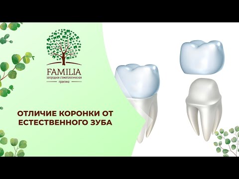 Можно ли отличить имплант от естественного зуба?