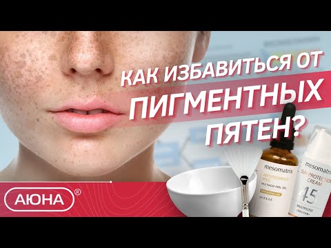 Pigment Spots | Causes and Treatments | Home and Professional Care