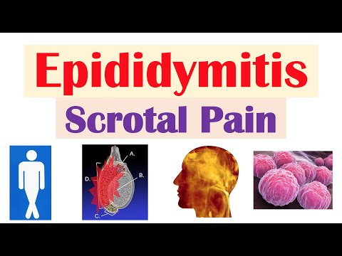Epididymitis (Scrotal Pain) | Causes, Risk Factors, Signs & Symptoms, Diagnosis, Treatment