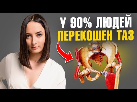 Don't Try to Fix Your Pevic Misalignment Until You Watch This Video | Exercises Will Only Make It...