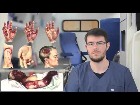 First aid for electrical injury