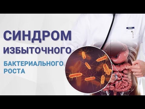 Синдром избыточного бактериального роста