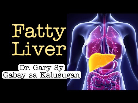 Fatty Liver: SGPT & SGOT - Dr. Gary Sy