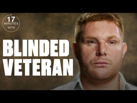 I Was Blinded By A Bomb In Afghanistan Aged 20 | Minutes With | @LADbible TV