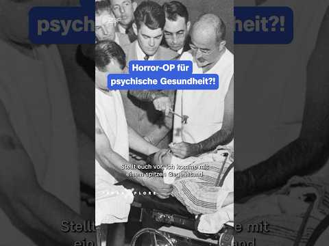 Lobotomie mit 23: Rosemary Kennedy! | #terraxplore #medizin #lobotomie