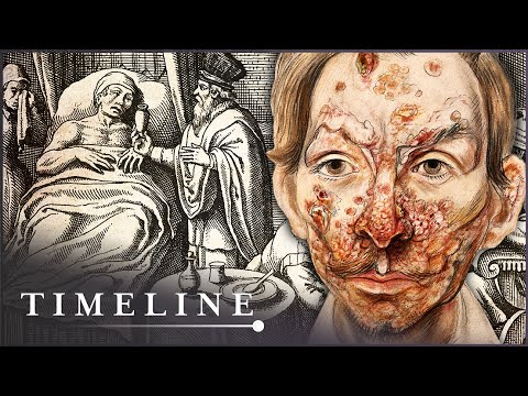 The True Terrors Of Tudor Medicine | Hidden Killers | Timeline