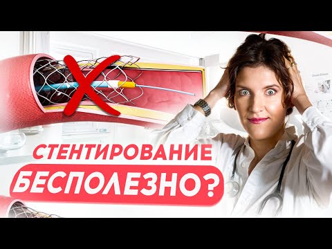 Stent in the Heart: When SURGERY IS NOT NEEDED? The whole truth about arterial stenting.