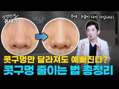 콧대, 코끝보다 중요하다고?! 한 끗 차이로 예뻐지는 콧구멍 줄이는 법 총정리!