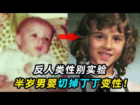 美国最反人性实验，男婴被迫切掉丁丁，当女孩抚养！