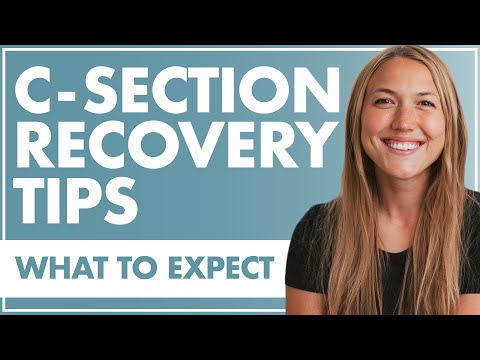 What To Know About C-SECTIONS + C SECTION AFTER CARE