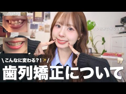 [Orthodontics] Was it worth it? 🦷 We'll tell you the real story, including costs, pain, and appea...