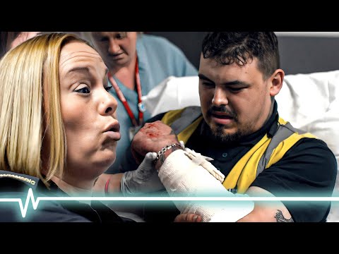 Worst Injuries Doctors Have Ever Seen