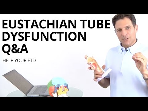 Q&A ETD - Eustachian Tube Dysfunction - Other remedies to try
