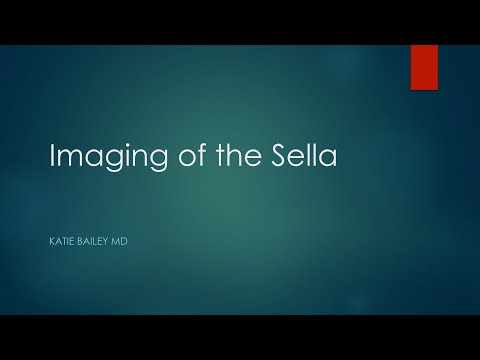 Imaging of the sella