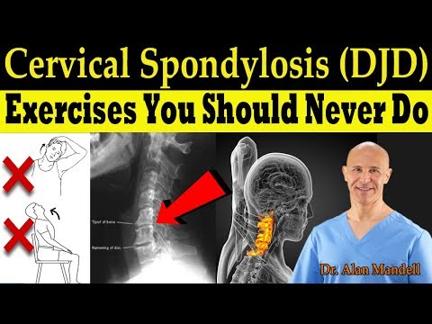 Cervical Spondylosis (DJD) Exercises You Should Never Do (Correct Exercises) - Dr. Alan Mandell, DC