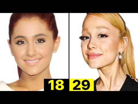 What Happened to Ariana Grande's Face? | Plastic Surgery Analysis
