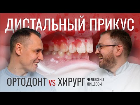 ДИСТАЛЬНЫЙ ПРИКУС. Ортодонт VS челюстно-лицевой хирург.