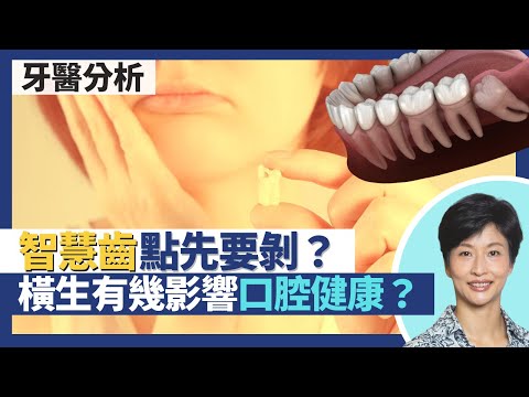 智慧齒｜如何決定是否拔除智慧齒？智慧齒橫生如何影響口腔健康？牙醫分析牙齒手術風險 剝智慧齒考慮上下一齊剝？｜王建芳醫生 牙科醫生李錦賓醫生｜人類健康研究所