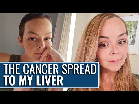 "I Let My Symptoms Go On Longer Than I Should Have!" | Stage 4 Colon Cancer | The Patient Story