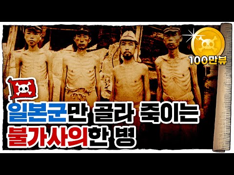 💀 에도시대부터 일본🇯🇵을 괴롭힌 희한한 질병?? / 💀 각기병은 어떻게 퇴치되었을까?