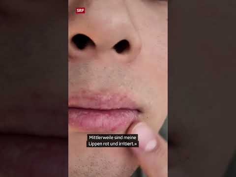 Wie funktionieren Mouth Tapes? | #Shorts | SRF Wissen