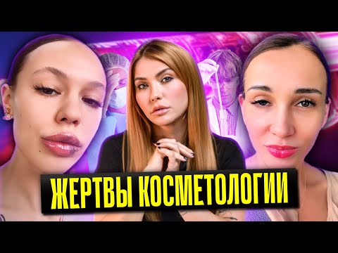 Жертвы косметологии I Инстасамка филлер I Анфиса Чехова ботокс