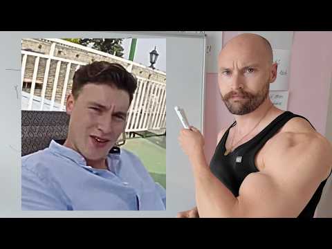 I Hated My Balding…Until I learnt THIS