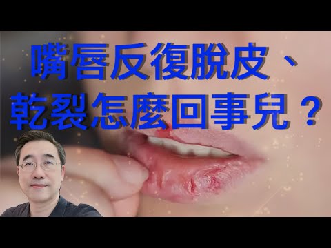 《唇美主義》嘴唇反復脫皮、乾裂怎麼回事兒？｜預防￼、中西醫藥 ｜cheilitis exfoliativa ｜［中文字幕］