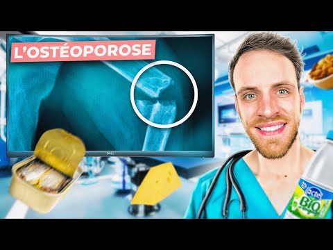 TOP 7 aliments anti ostéoporose 🧀 (le lait : interdit ?)