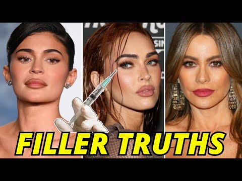 Plastic Surgeon Answers YOUR Facial Filler Questions!! NOTHING HELD BACK!