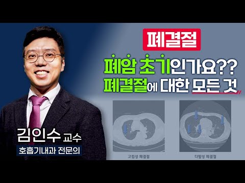 건강검진때 흉부 엑스레이에 나온 폐결절, 치료가 필요할까요? 폐결절에 대한 모든 것을 알려드립니다  [ TV닥터인사이드 ] 230130