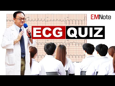 ECG Quiz for ACLS and Clinical Practice