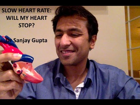 Slow heart rate or Bradycardia: Will my heart stop?