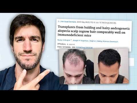 Why I think Full Hair Regrowth Is Possible, Sooner than Later