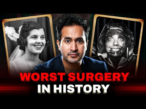 Lobotomy – The Most Horrifying Surgery in History