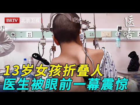13岁大山女孩身体折叠100度，医生掀开衣服，被眼前一幕震惊【医者】