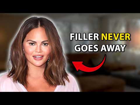 The Scary Truth About Filler | Plastic Surgeon Reacts