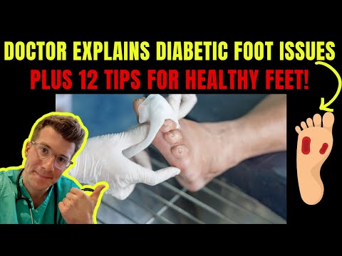 Doctor explains DIABETIC FOOT COMPLICATIONS - PLUS 12 TIPS FOR PREVENTION!