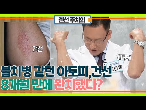 건선,아토피 8개월 만에 완치! 떨어진 면역력 올리는 방법! MBN 230926 방송