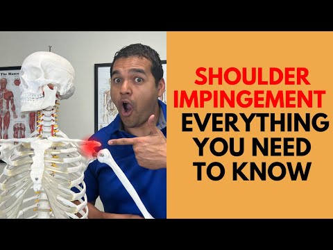 Shoulder Impingement: Everything You Need To Know To Get Healthy Again