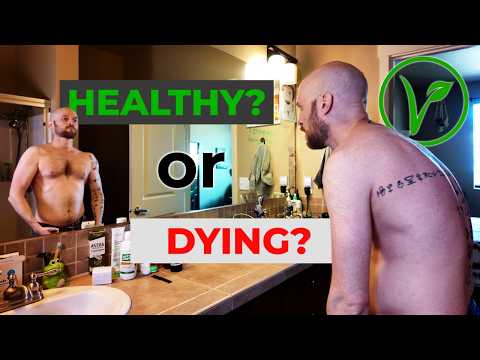 Full Bloodwork After 15 Years On a Vegan Diet