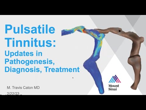 Pulsatile Tinnitus: Updates in Pathogenesis, Diagnosis, Treatment, Travis Caton, MD 02.22.2023