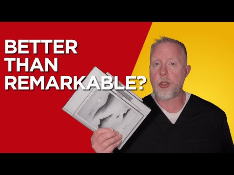 Can Viwoods Beat Supernote or Remarkable? My First Impressions