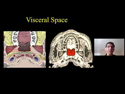 Head & Neck Spaces Made Simple, Dr. Suresh Mukherji, Medality (MRI Online) Radiology Noon Conference