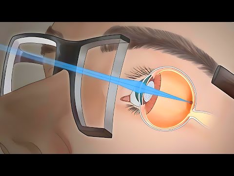 How Glasses Work: The Science Behind Clear Vision