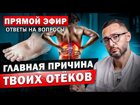 Главные причины ОТЕКОВ. Что делать?