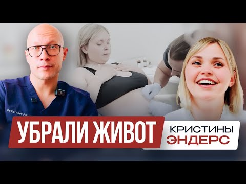 УБРАЛИ ЖИВОТ за 3 часа КРИСТИНЕ ЭНДЕРС | Полное преображение! Восстановление после родов