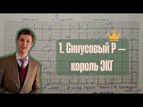 Алгоритм анализа ЭКГ | 1. Синусовый зубец P — король ЭКГ