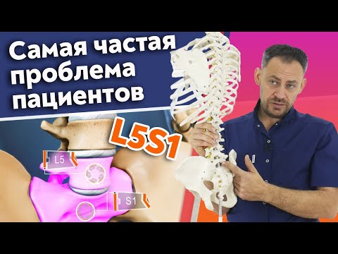 Грыжа L5 S1 / Как лечить межпозвонковую грыжу поясничного отдела?