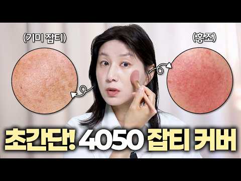 Perfect Coverage for Freckles and Blemishes‼️How to Apply Concealer for a Makeup Master‼️Now, App...
